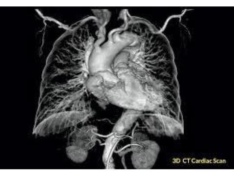 Cardiac CT scan Beveridge