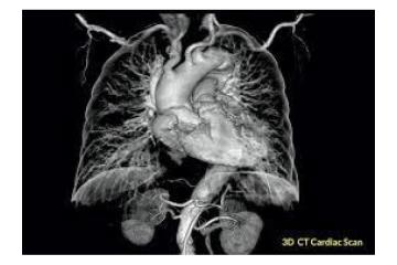 Cardiac CT scan Beveridge
