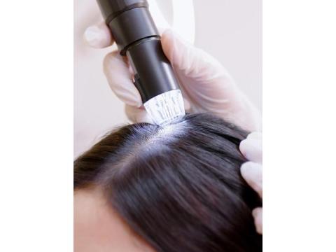 Hair Growth Scalp Treatment Spring Hill