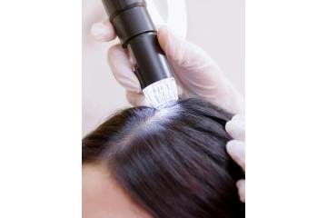 Hair Growth Scalp Treatment Spring Hill