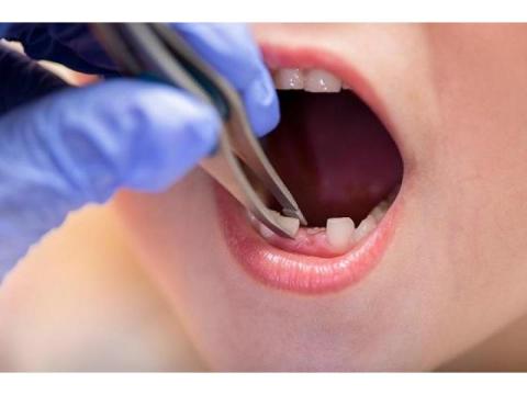 Fast Dental Assistance for Unexpected Oral Problems