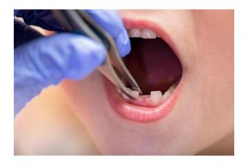 Fast Dental Assistance for Unexpected Oral Problems