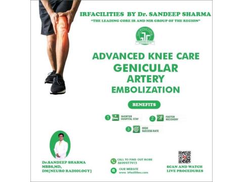Advanced Pain Relief with Genicular Artery Embolization Treatment