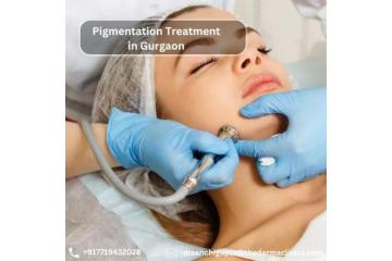 Pigmentation Treatment in Gurgaon for Clear & Even Skin