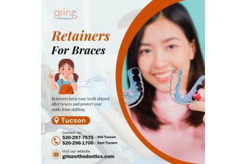 Retainers For Braces in Tucson