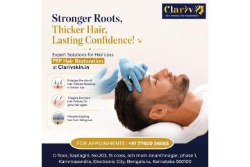 Best Hair Transplant Clinic in Bangalore for Natural Results | Clarivskin.in