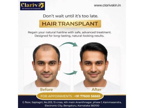 Best Hair Transplant Clinic in Bangalore for Natural Results | Clarivskin.in - 2/2