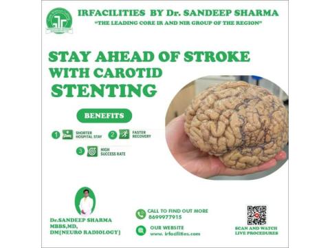 Affordable Carotid Artery Stenting in India
