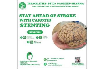 Affordable Carotid Artery Stenting in India