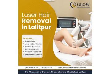 Laser Hair Removal in Lalitpur for Perfect Hairstyle