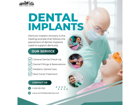 Signs Your Dentures Implants Recovery Is Progressing Normally !