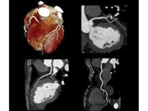 Heart Craigieburn