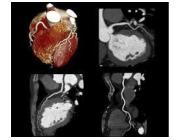 Heart Craigieburn