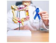 Trusted Colorectal Cancer Doctor in Noida for Treatment