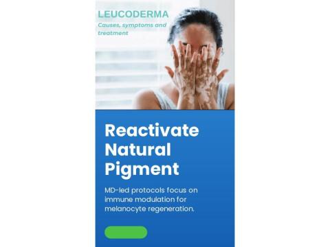 Can White Patches Spread? Aura Homeopathy Treatment for Leucoderma - 2/2