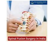 Spinal Fusion Surgery in india