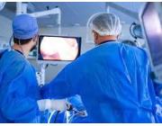 Video Laparoscope
