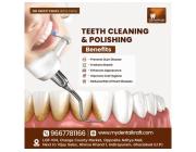 Teeth Cleaning in Indirapuram for Better Oral Health and a Brighter Smile