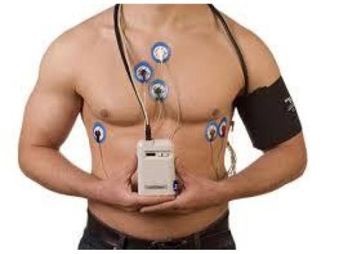 Holter monitor Craigieburn