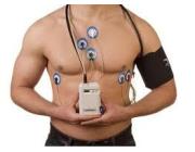 Holter monitor Craigieburn