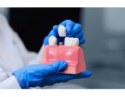Best Dental Implants Melbourne for a Confident Smile