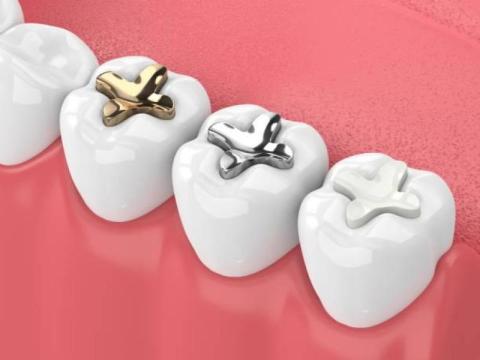 Top Wisdom Teeth Removal Melbourne CBD Dental