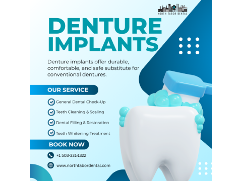 Can Denture Implants Improve Your Quality of Life?