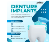 Can Denture Implants Improve Your Quality of Life?
