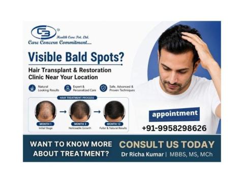 Visible Bald Spots? Hair Transplant & Restoration Clinic Near Your Location