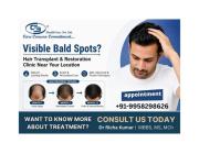 Visible Bald Spots? Hair Transplant & Restoration Clinic Near Your Location