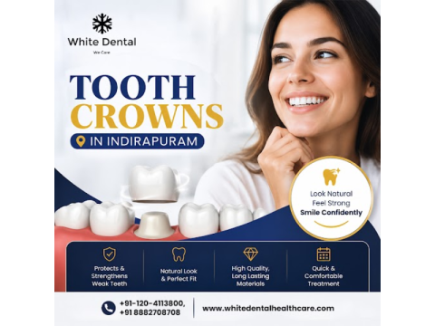 Tooth Crowns in Indirapuram for Restoring Damaged Teeth