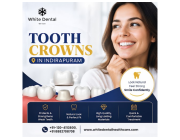 Tooth Crowns in Indirapuram for Restoring Damaged Teeth