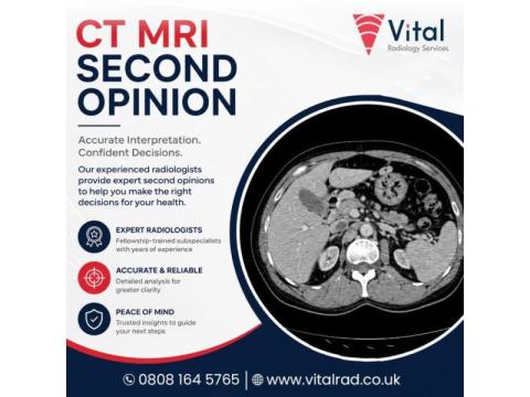 CT MRI Second Opinion Services for Expert Diagnostic Accuracy