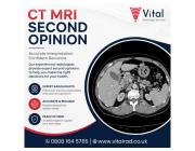 CT MRI Second Opinion Services for Expert Diagnostic Accuracy