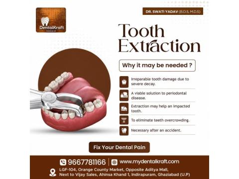 Best Dentist for Tooth Extraction in Indirapuram for Safe and Pain-Free Care