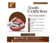Best Dentist for Tooth Extraction in Indirapuram for Safe and Pain-Free Care