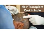 Cost of Hair Transplant in Delhi | MedLinks Hair Transplant