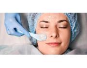 Get Chemical Peel treatment in Gurgaon for Skin Rejuvenation | Estique Clinic