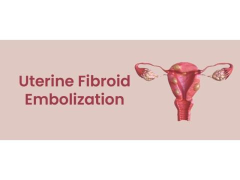 Uterine Fibroid Embolization | Minimally Invasive Fibroid Care