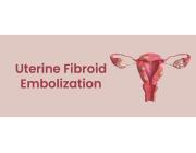 Uterine Fibroid Embolization | Minimally Invasive Fibroid Care