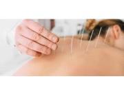 Best Acupuncture Clinic Dubai
