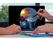 Brain Tumour Operation Cost with Advanced Diagnostic Technology