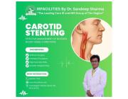 Carotid Stent Procedure: A Highly Effective Technique in Preventing Stroke