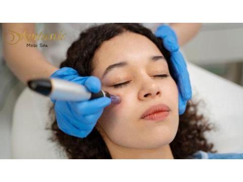 Best Potenza Microneedling Near Me in Riverside
