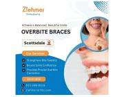 Overbite Braces in Scottsdale