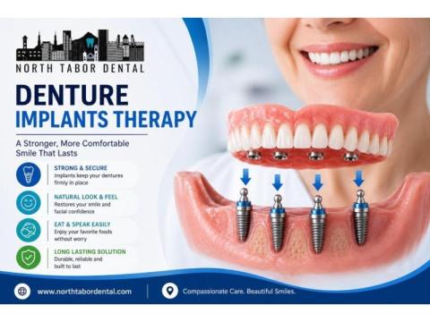 Is Denture Implants Therapy Right for You?
