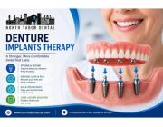 Is Denture Implants Therapy Right for You?