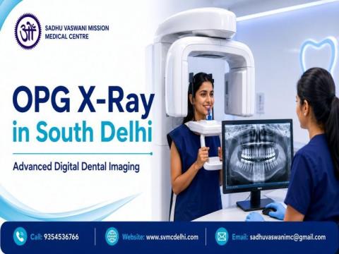 OPG X-Ray in South Delhi | Digital Dental X-Ray Services at SVMC