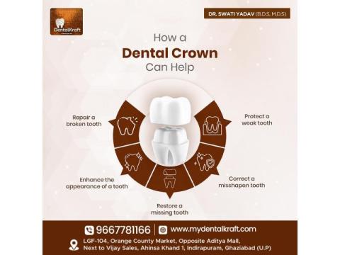 Dentist in Indirapuram for Advanced Dental Care