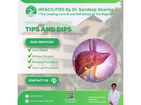 Tips Procedure Radiology | Minimally Invasive Imaging Procedure